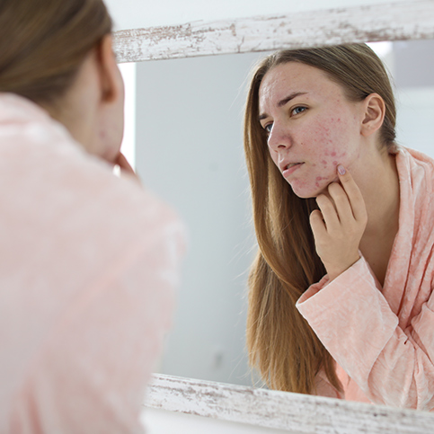 woman looking at acne