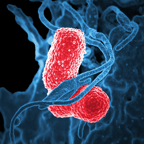 pneumonia bacteria